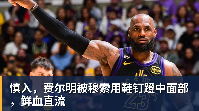 九游体育慎入，费尔明被穆索用鞋钉蹬中面部，鲜血直流